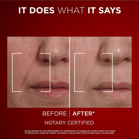 Astria Eye Bag Eraser