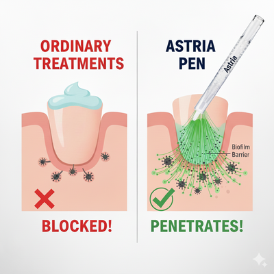 Astria Antifungal Pen
