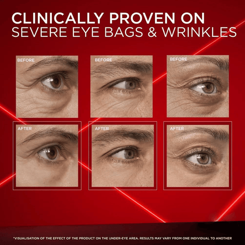 Astria Eye Bag Eraser