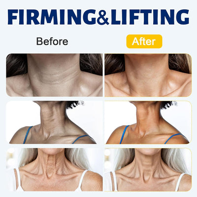 Astria Neck Firming Cream